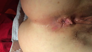 dilatation de son trou du cul